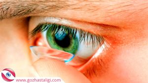 akıllı lens zararları, akıllı lens, akıllı lens takma,